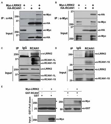 Leucine-Rich Repeat Kinase 2 (LRRK2) Stimulates IL-1β-Mediated Inflammatory Signaling through Phosphorylation of RCAN1